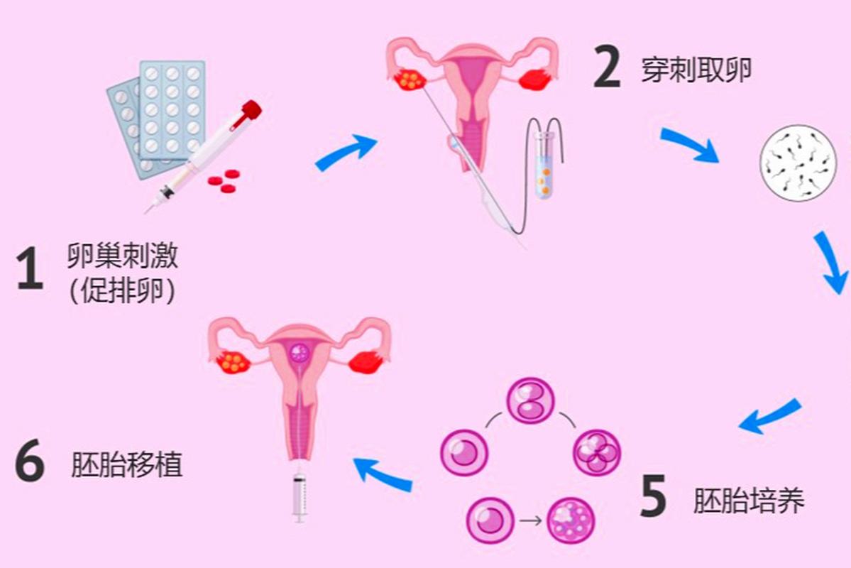 试管婴儿取卵过程详解：针从哪里进？