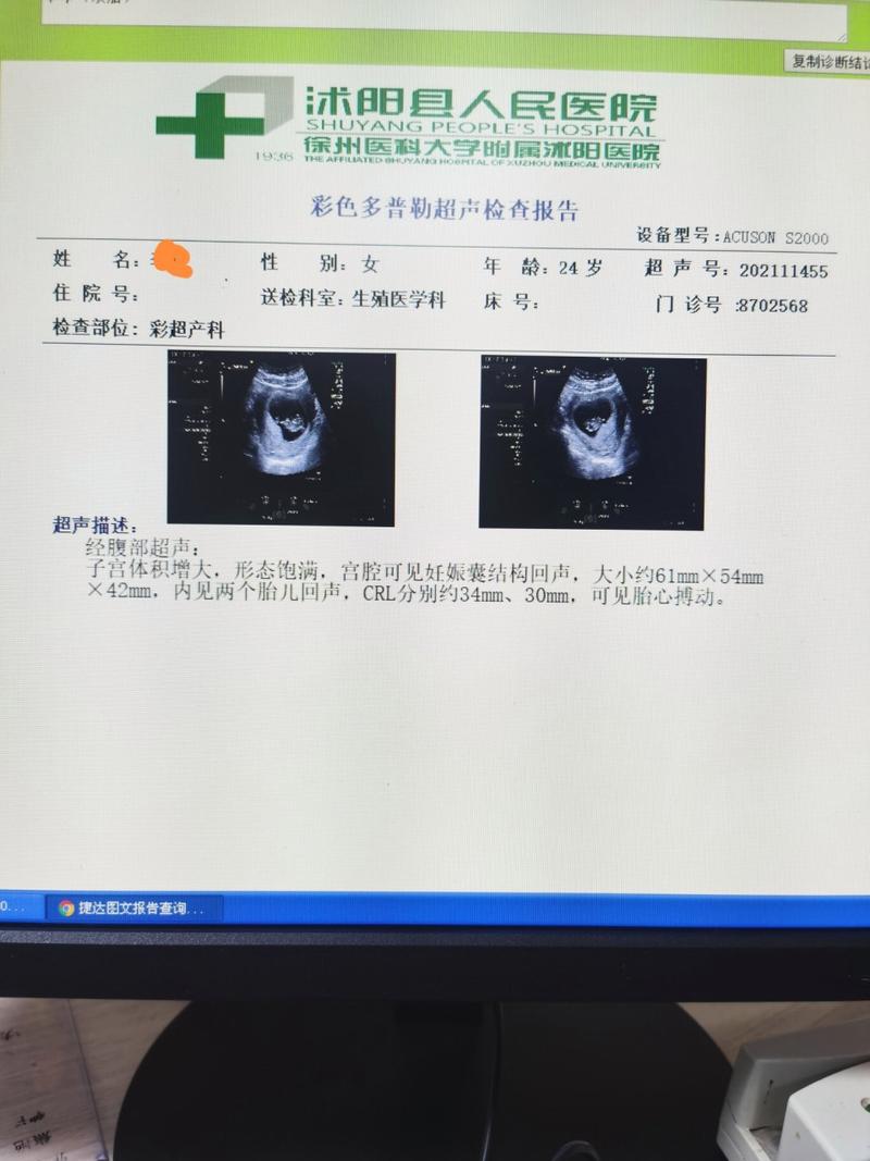 试管婴儿、男性超声检查、生殖健康