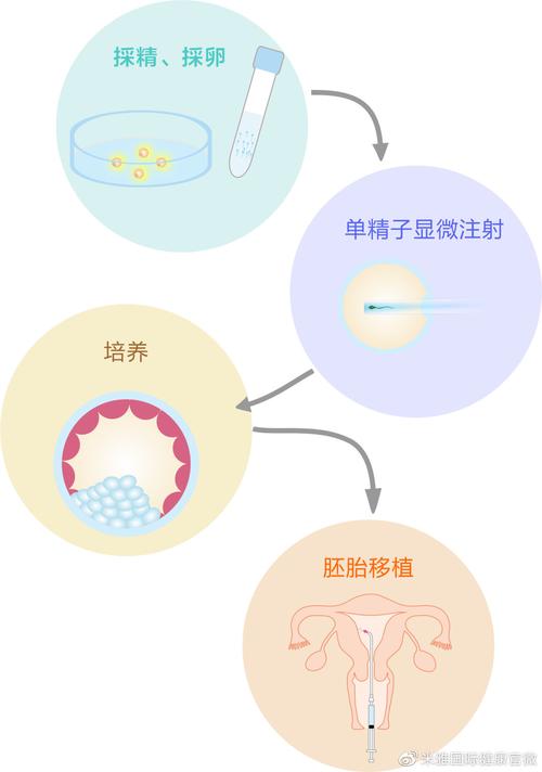 - 试管婴儿技术：谁才是合适的伴侣？