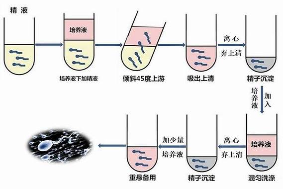 精子洗涤技术