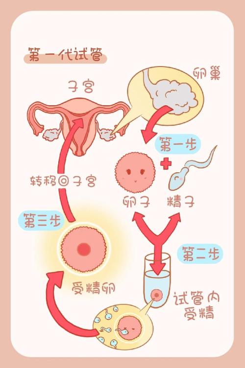 试管婴儿过程