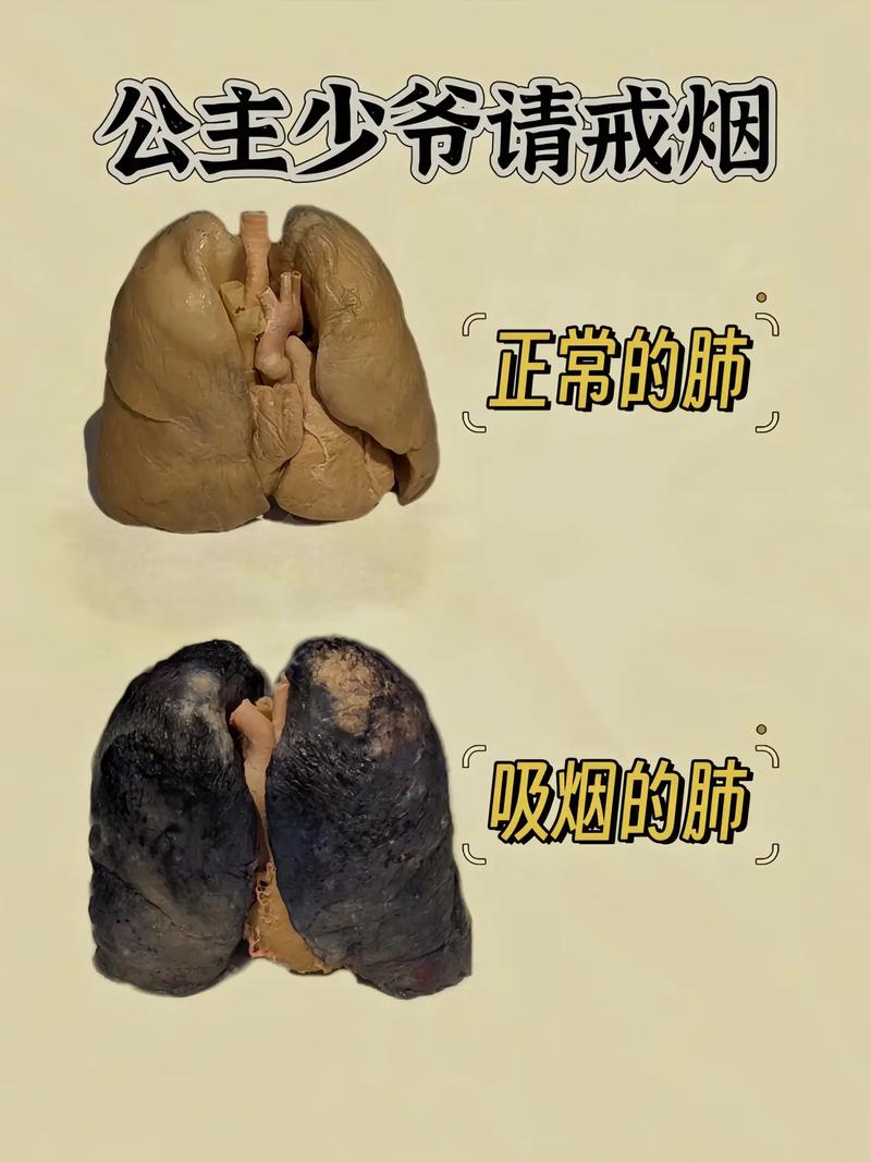  吸烟影响