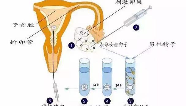 揭秘试管婴儿取卵全过程：能取完吗？