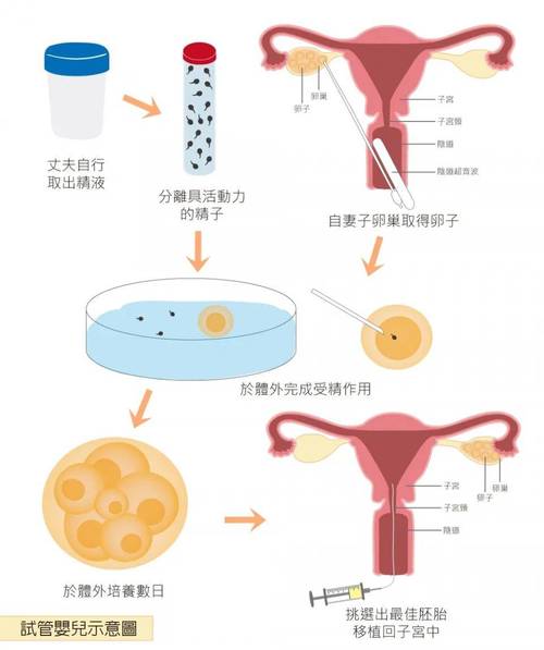 试管婴儿是用母亲的卵子进行受精的吗？