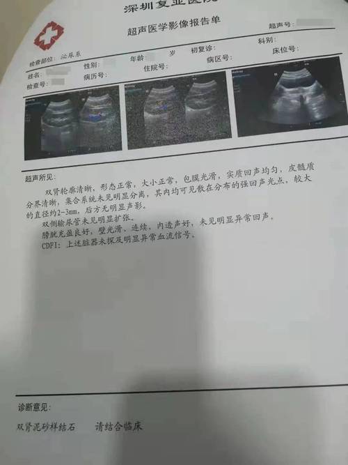 试管婴儿手术期间该怎么处理肾结石？