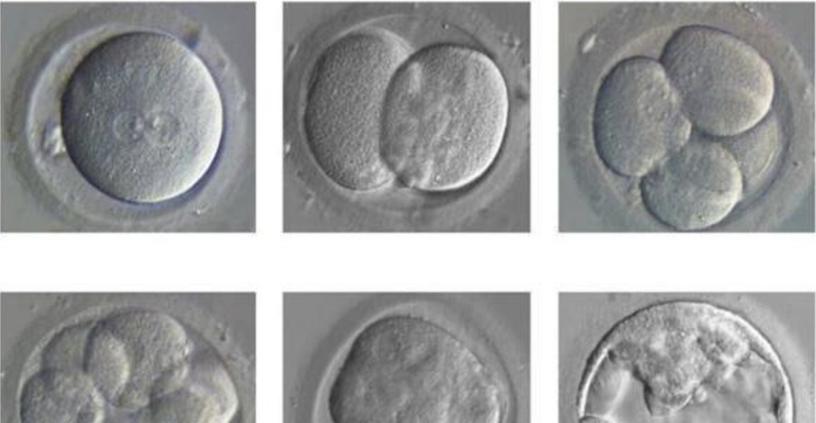 试管婴儿：92的胚胎是否就是完美的？