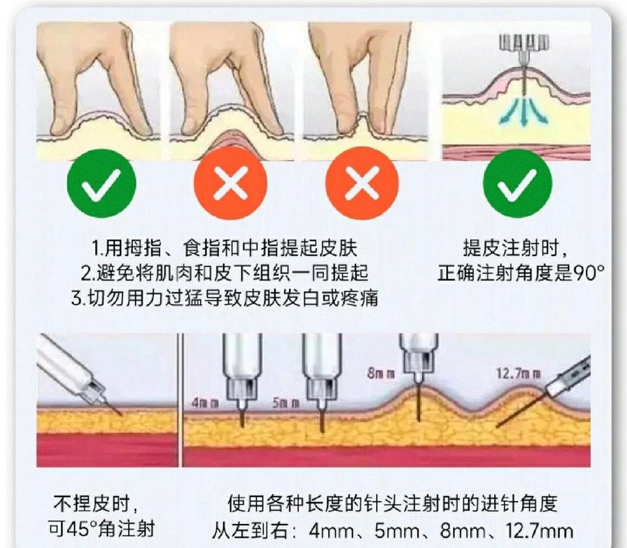 自我注射肝素