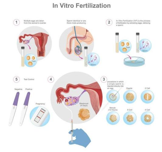 试管婴儿取决于遗传，和过程无关吗？