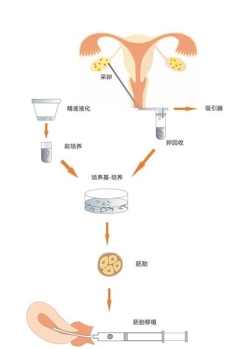 试管婴儿、自然顺产、生殖医疗