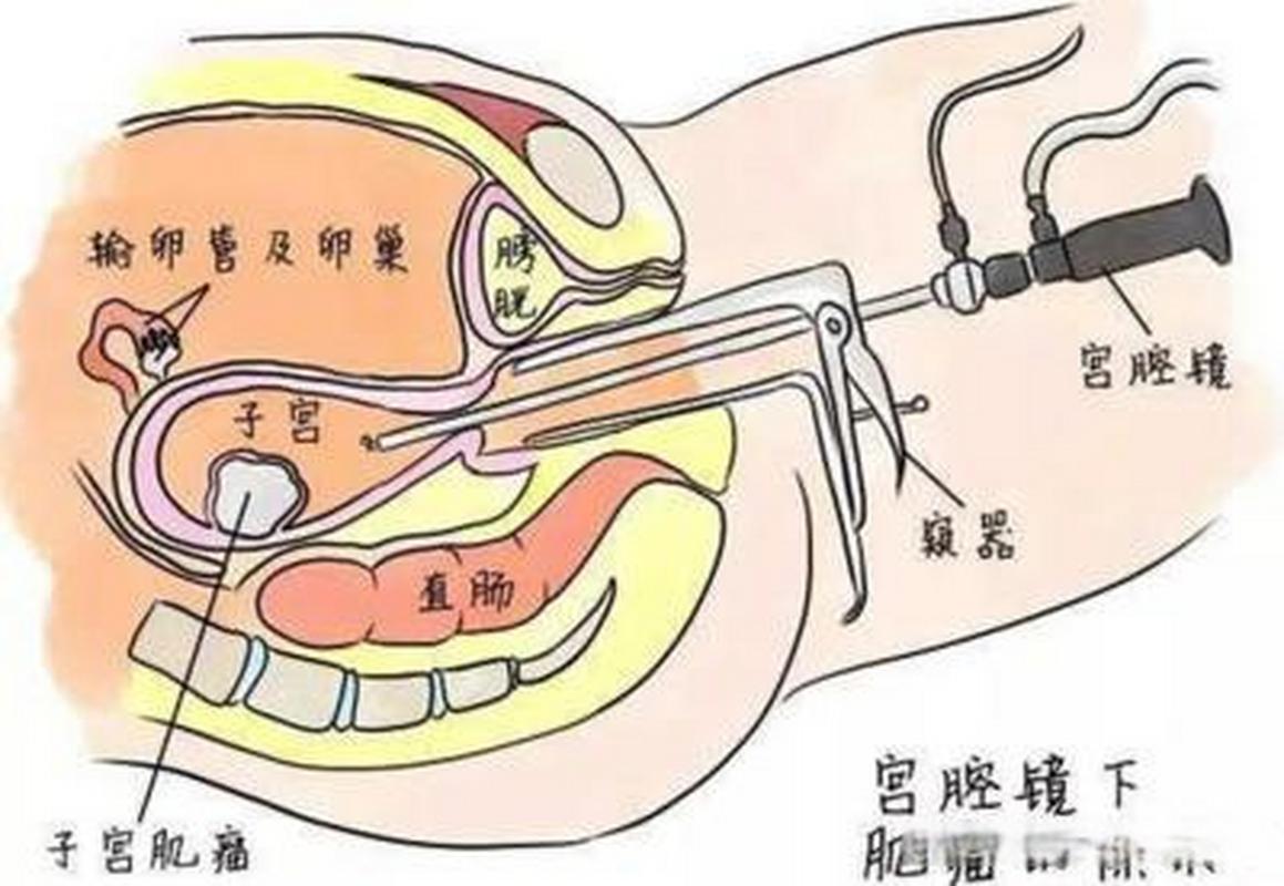 轻微不适感