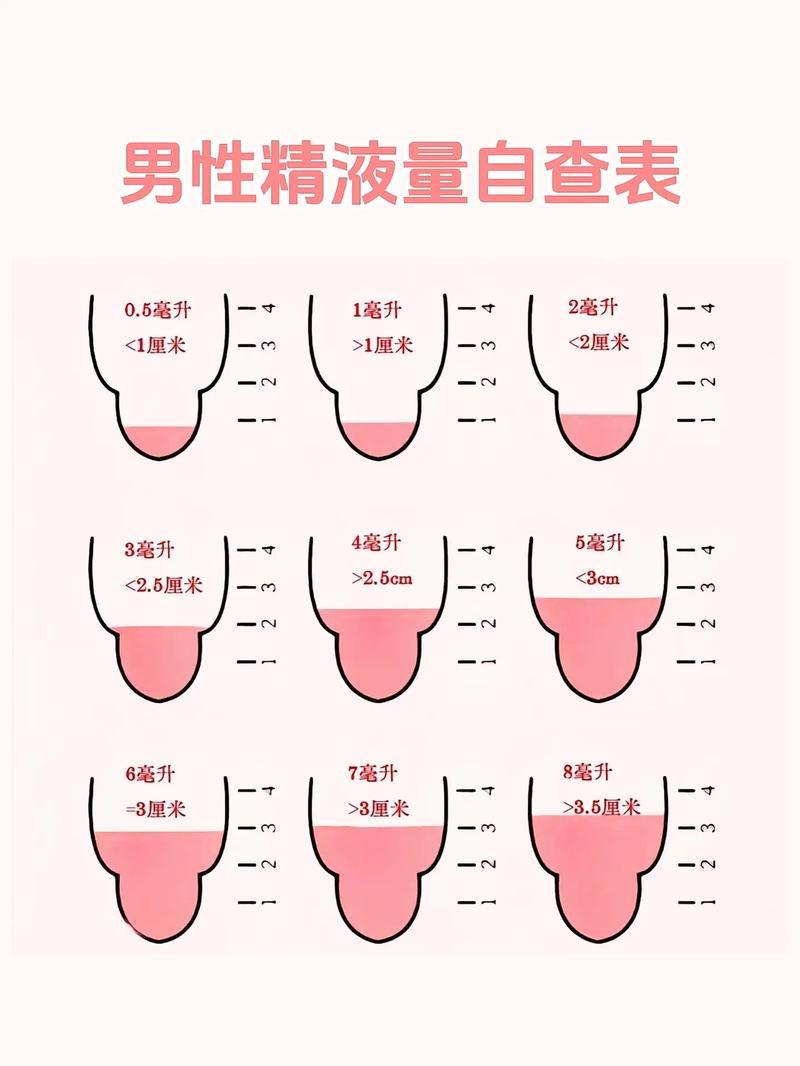 精子类型