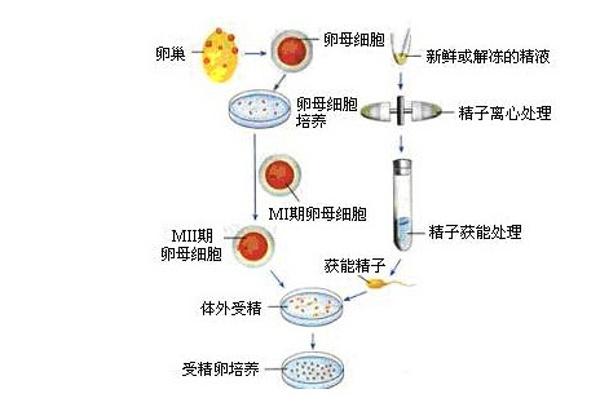 试管婴儿第一代技术