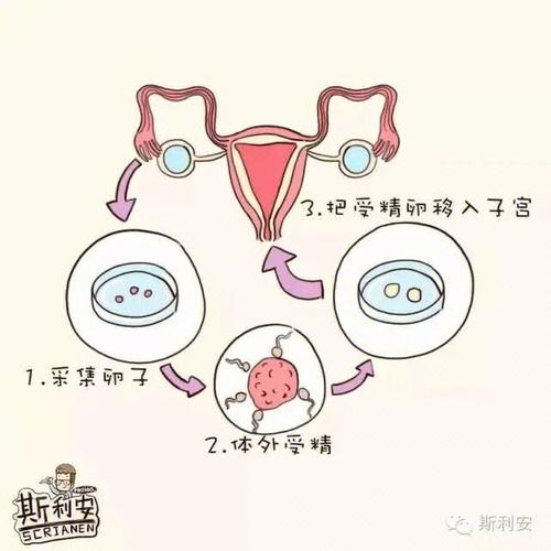 试管婴儿与天然受孕有排异反应吗？