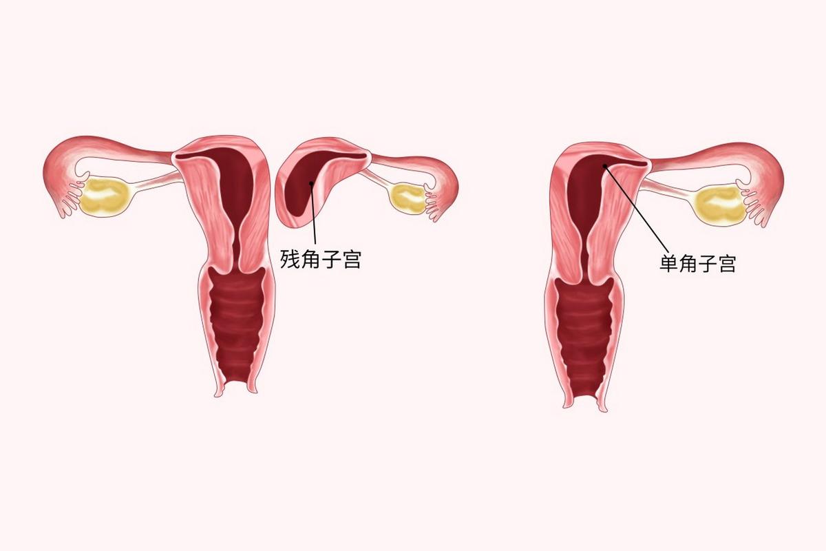 谁更适合做试管婴儿的子宫提供者？