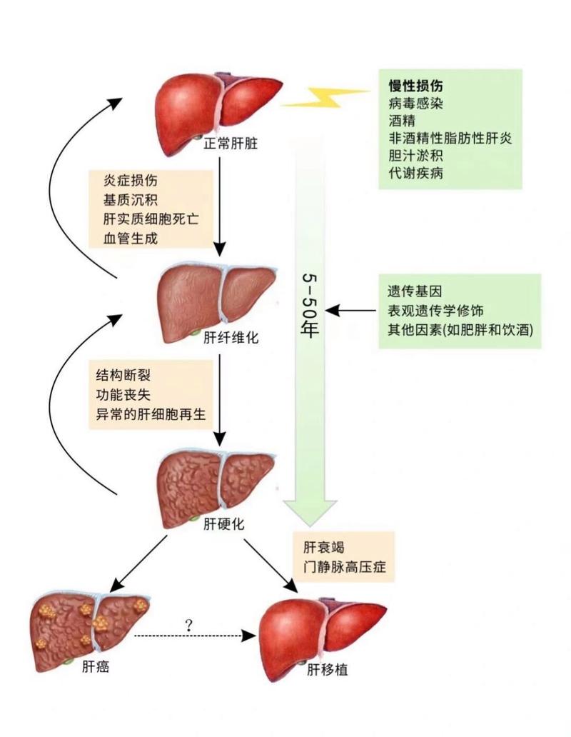 肝脏疾病