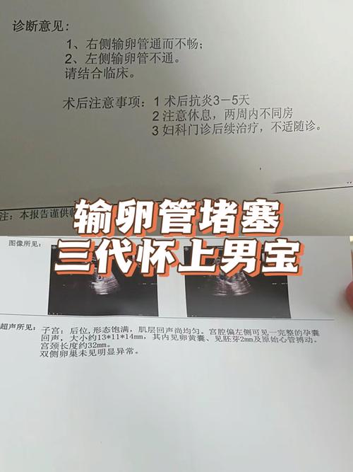 试管婴儿成功后需要输卵管复通吗？