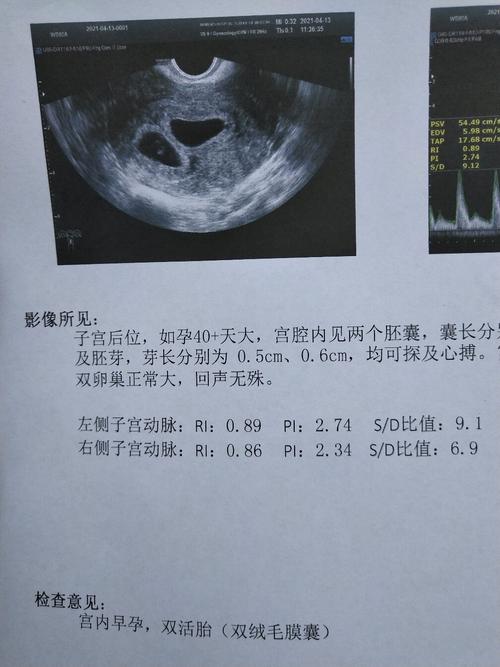 移植四十天