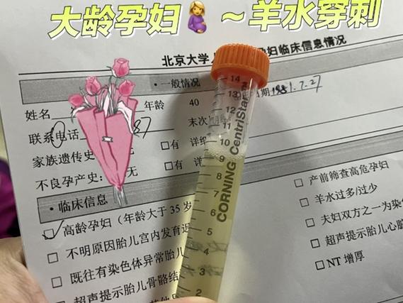 试管婴儿可进行羊水穿刺检查吗？