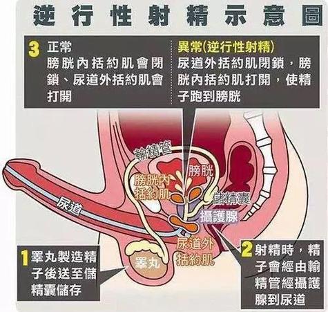 试管婴儿中男性精子获取方法揭秘