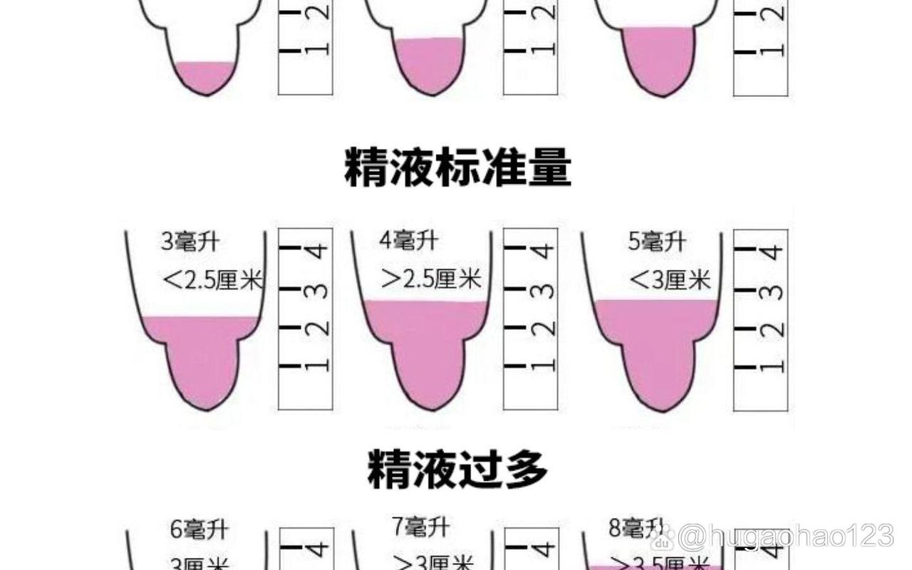 男方精子情况