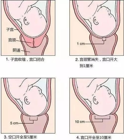 试管婴儿的真实感受：也要经历分娩吗？