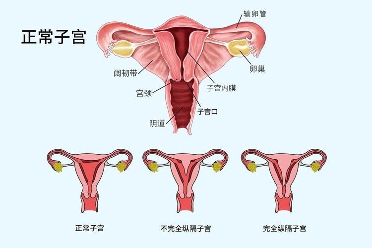 纵膈子宫