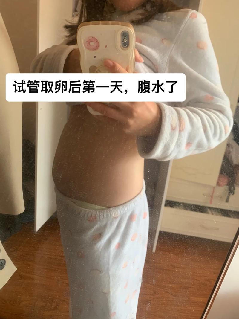 试管婴儿手术后为何肚子会变硬？