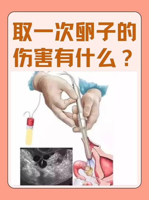 试管婴儿取卵为何成熟率低？