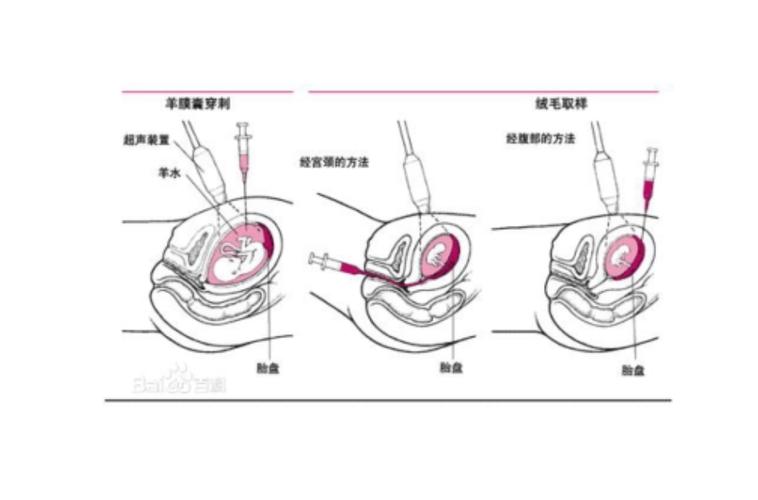  胚胎取样