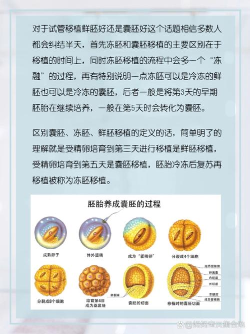 试管婴儿成功率：囊胚的关键作用