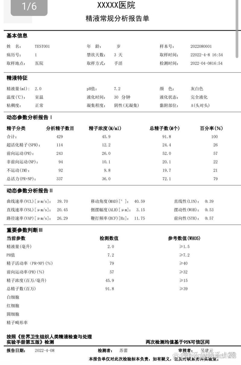  精子浓度