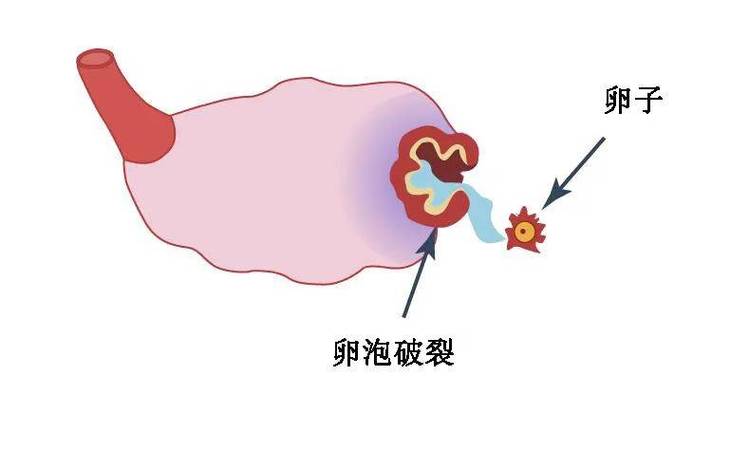  扳机排卵