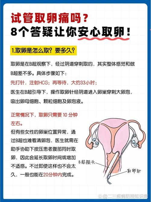 试管婴儿、取卵疼痛、缓解方法