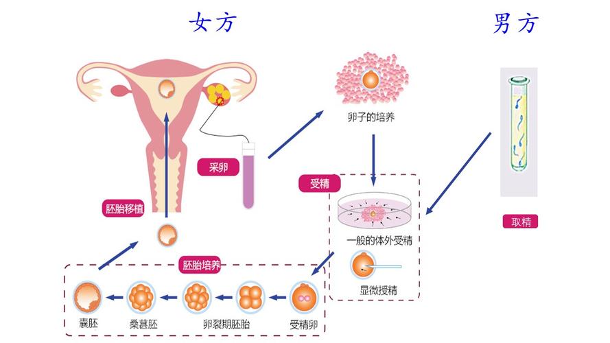 生殖支持