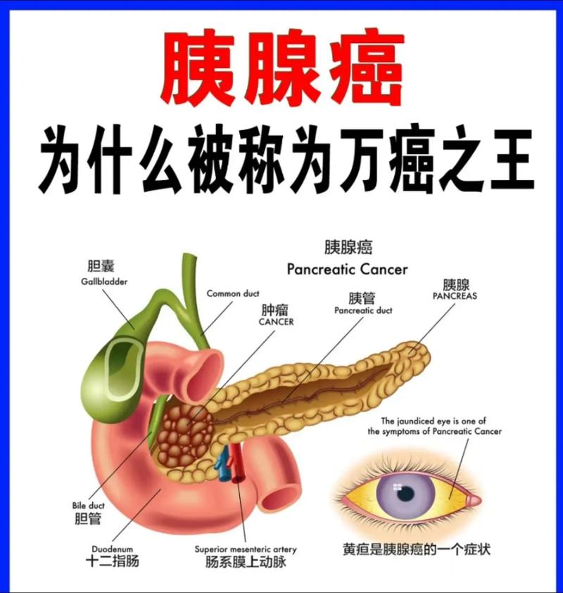 胰腺健康