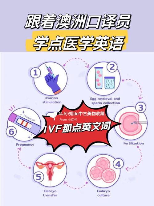  英国IVF