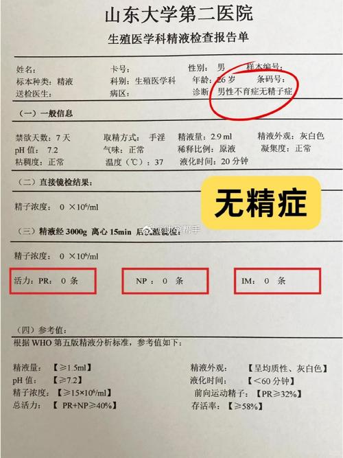 男方无精症